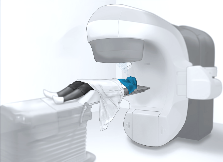 Scan to stent workflow