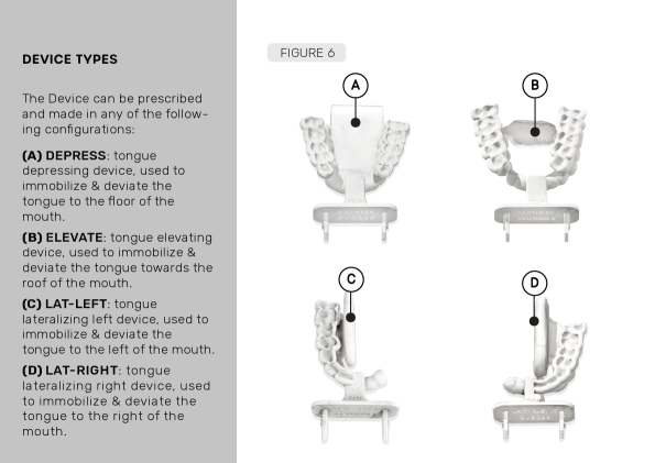 Stentra™ types